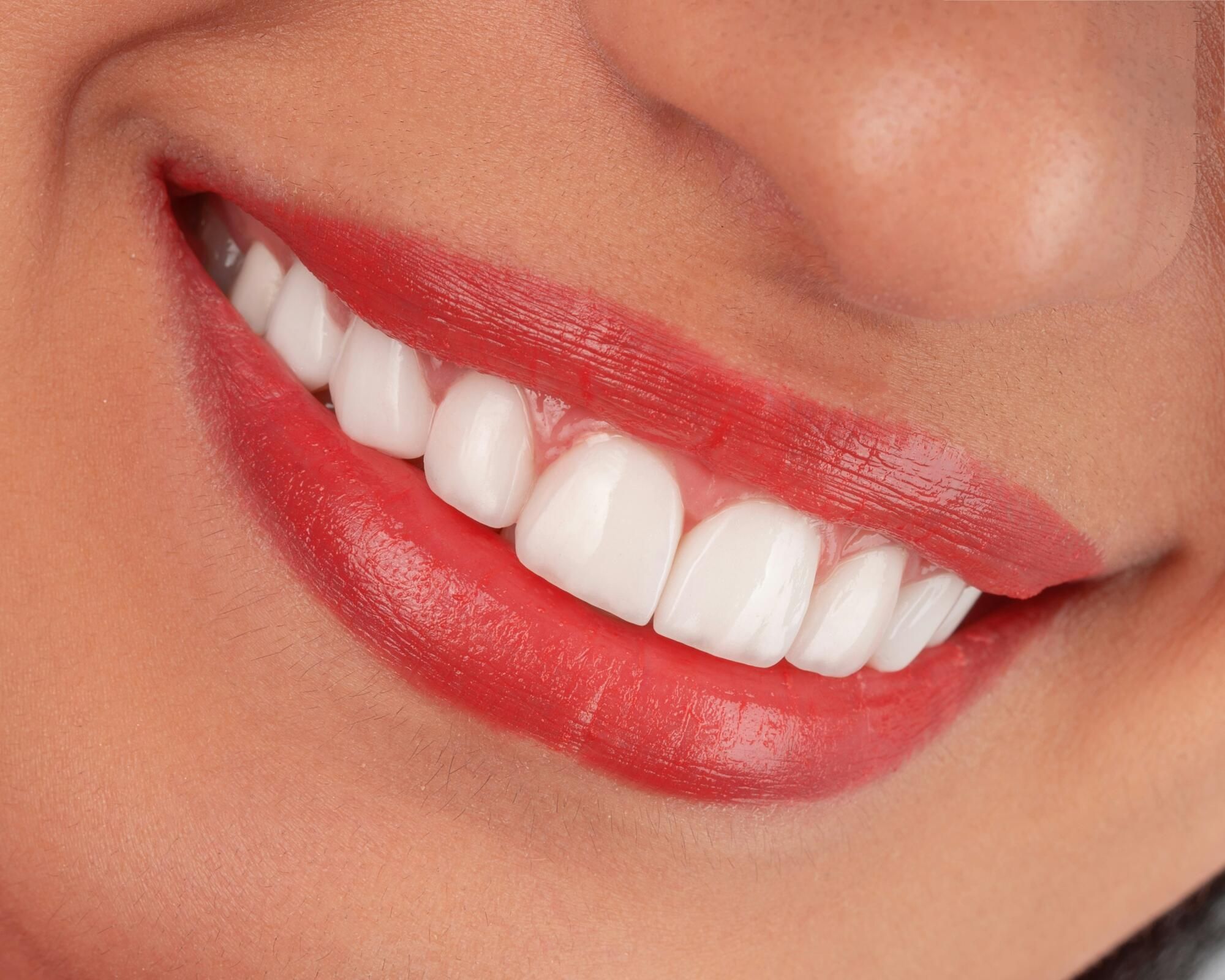 Miley Cyrus teeth: The journey behind her iconic smile